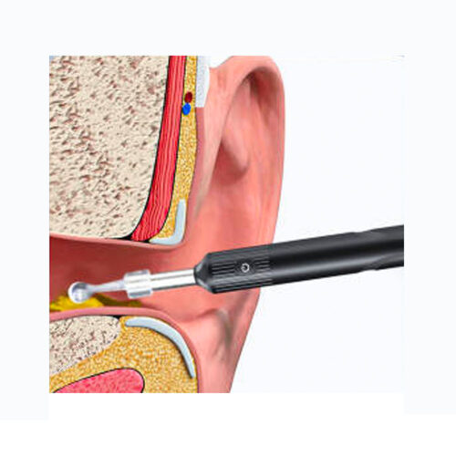 Wifi visual ear endoscope